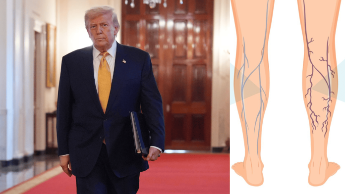 trump-7-2